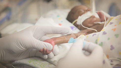 Condiciones especiales en bebés prematuros