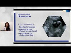 Embedded thumbnail for Cuidados para un embarazo durante la contingencia